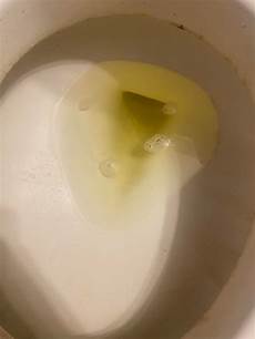 Foam Layer