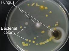 Mold In Toilet