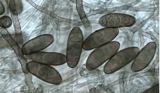 Mold Spores