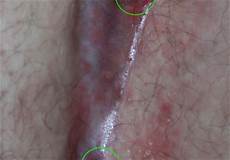 Mold Treatment