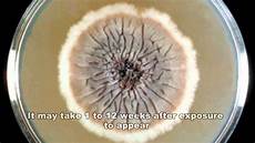 Mold Treatment