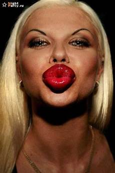 Plastic Injections