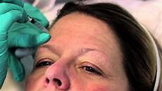 Plastic Injections