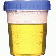 Polypropylene Sample Collection Cup