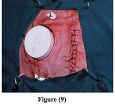 Polypropylene String