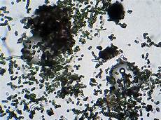 Stachybotrys Mold