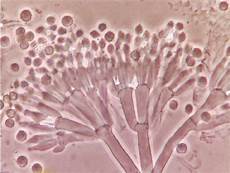 Stachybotrys