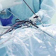 Surgical Polypropylene Mesh