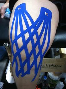 Tape
