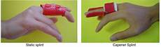 Thermoplastic Splint
